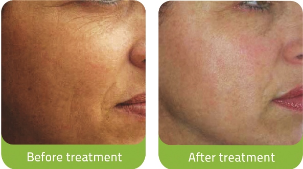 The Matrix arrives in Oz - Professional Beauty